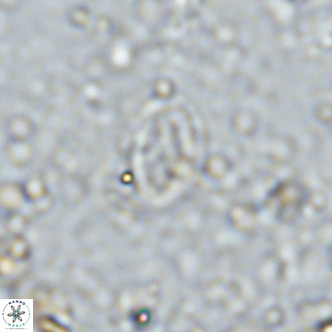 Gartnerago margaritatus VR 13553
