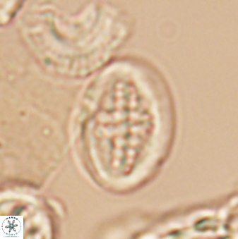 Gartnerago costatum 9705
