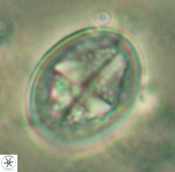 Gartnerago diversum 5087