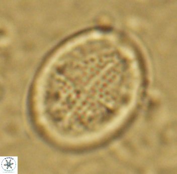 Gartnerago diversum 5088
