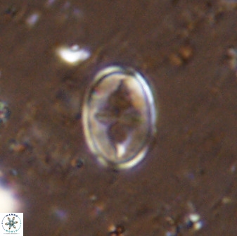 Gartnerago ponticula 48665