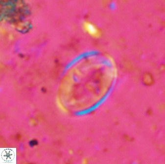 Gartnerago ponticula 48670