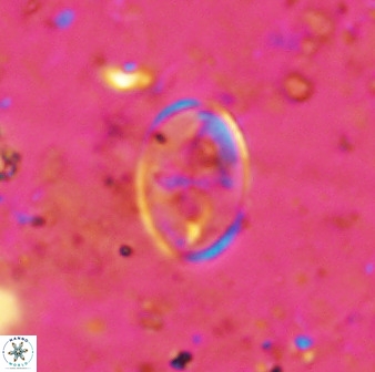 Gartnerago ponticula 48671