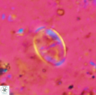 Gartnerago ponticula 48672
