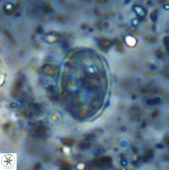Gartnerago ponticula 48674