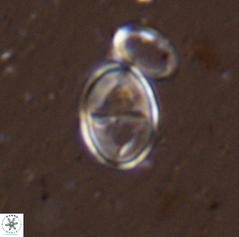 Gartnerago ponticula 48821