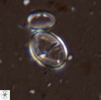 Gartnerago ponticula 48823