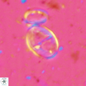 Gartnerago ponticula 48824