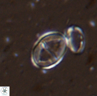 Gartnerago ponticula 48825