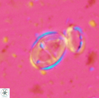 Gartnerago ponticula 48826