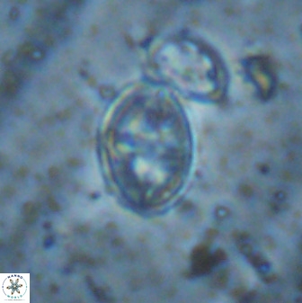 Gartnerago ponticula 48828