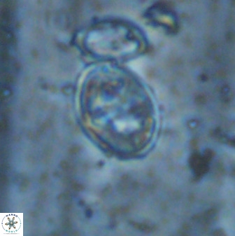 Gartnerago ponticula 48829