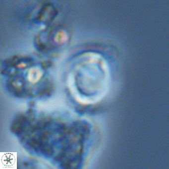 Gephyrocapsa grandis VR 03833