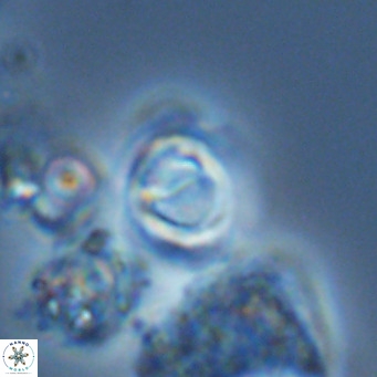 Gephyrocapsa grandis VR 03835
