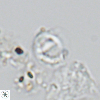 Gephyrocapsa grandis VR 03837