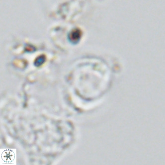 Gephyrocapsa grandis VR 03839