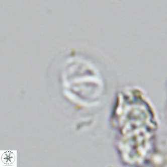 Gephyrocapsa grandis VR 03945