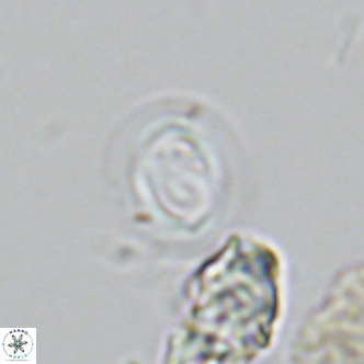 Gephyrocapsa grandis VR 03947