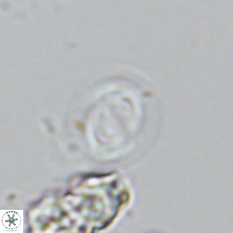 Gephyrocapsa grandis VR 03948