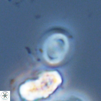 Gephyrocapsa grandis VR 03949