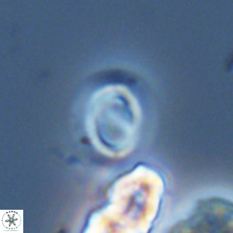 Gephyrocapsa grandis VR 03951