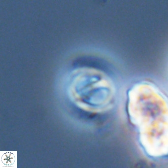 Gephyrocapsa grandis VR 03952