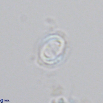Gephyrocapsa oceanica VR 04179
