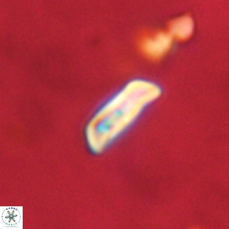 Goniolithus fluckigeri VR 00814