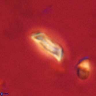 Goniolithus fluckigeri VR 00823