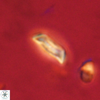 Goniolithus fluckigeri VR 00823