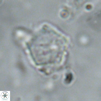 Goniolithus fluckigeri VR 01508