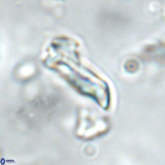 Goniolithus fluckigeri VR 01518