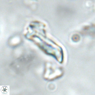 Goniolithus fluckigeri VR 01518