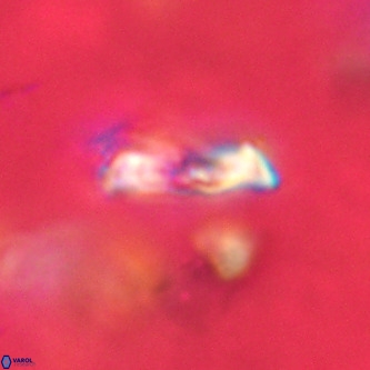 Goniolithus fluckigeri VR 01526