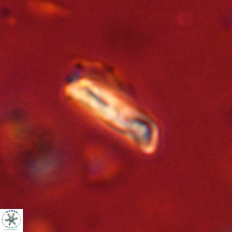 Goniolithus fluckigeri VR 01528
