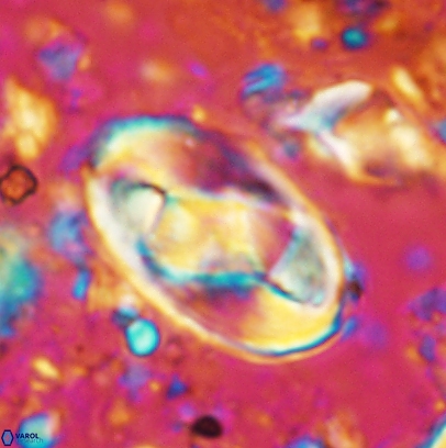 Gorkaea obliqueclausus 4529