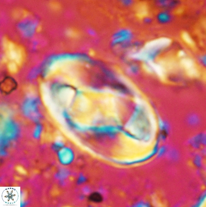 Gorkaea obliqueclausus 4529