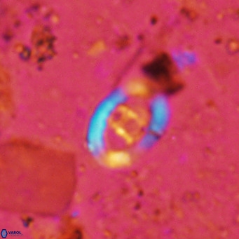 Gorkaea operio VR 15940