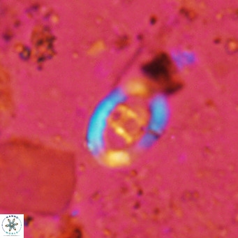Gorkaea operio VR 15940
