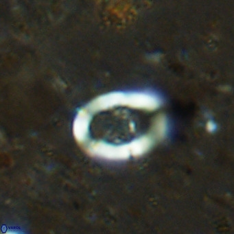 Gorkaea operio VR 15941