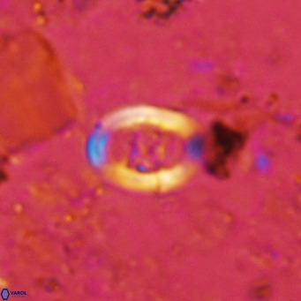 Gorkaea operio VR 15945