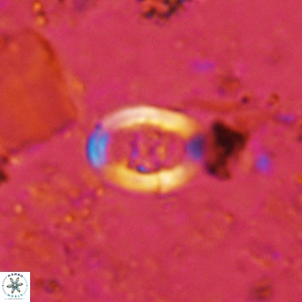 Gorkaea operio VR 15945