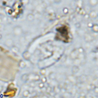 Gorkaea operio VR 15948