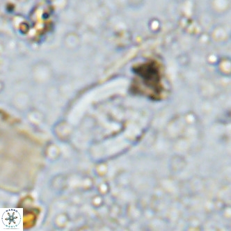 Gorkaea operio VR 15948
