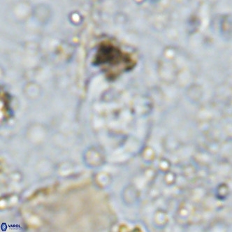 Gorkaea operio VR 15949