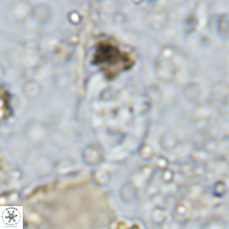 Gorkaea operio VR 15949