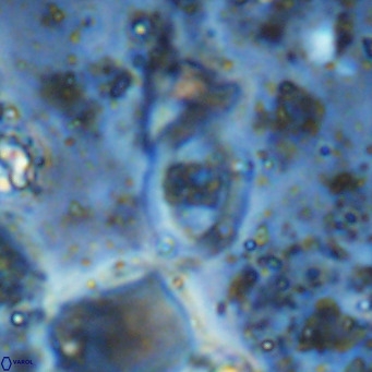 Gorkaea operio VR 15952