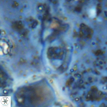 Gorkaea operio VR 15952