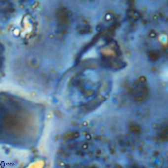 Gorkaea operio VR 15954