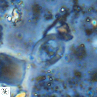 Gorkaea operio VR 15954